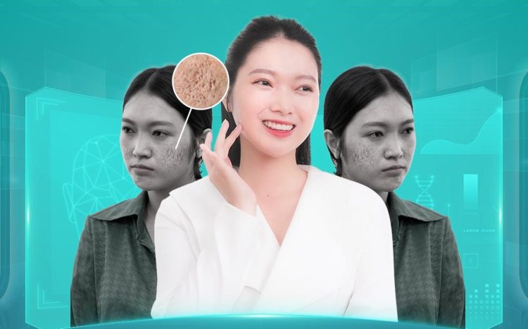 Trị sẹo công nghệ cao Lasik Scar – Đột phá mới trong điều trị sẹo tại Viện thẩm mỹ Phương Đông.